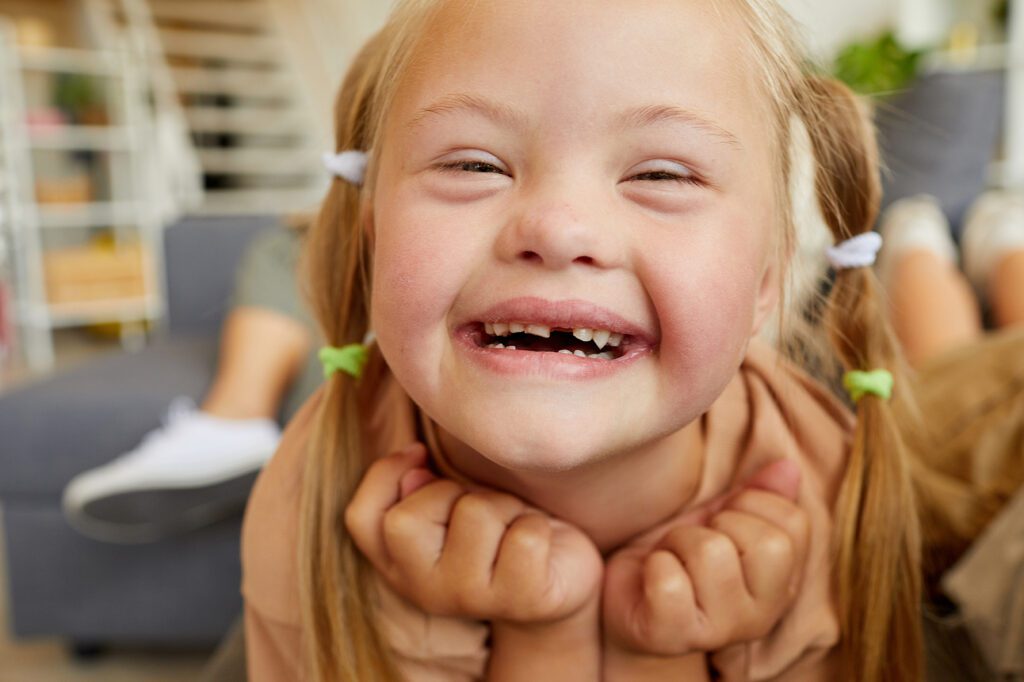 Girl-with-Down-Syndrome-Smiling-Big